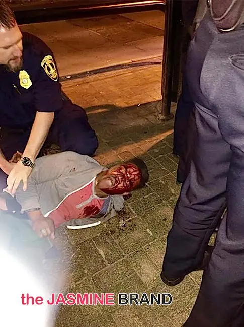Black University of VA Student, Martese Johnson, Receives Bloody Arrest by Police-the jasmine brand