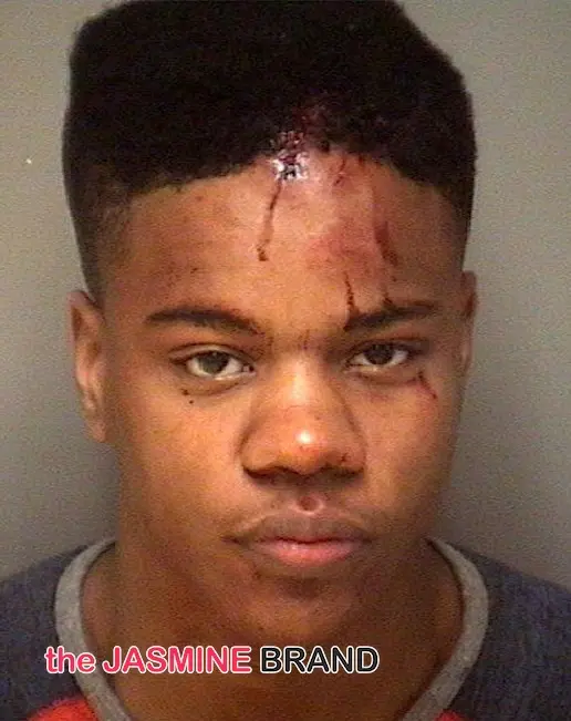 Black University of VA Student-Martese Johnson-Receives Bloody Arrest by Police-the jasmine brand