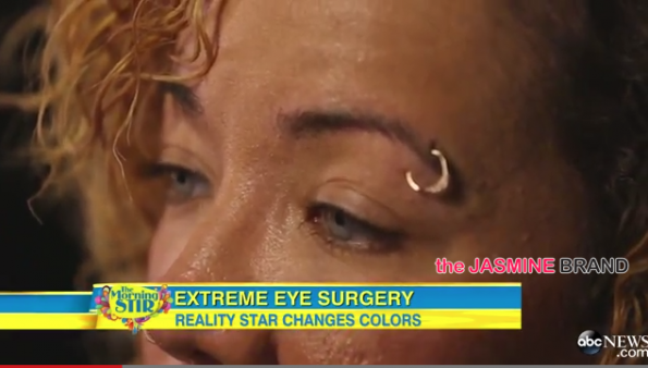 Tiny Defends Controversial Eye-Coloring Surgery on GMA-the jasmine brand