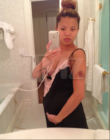 [Photos] Yikes! The Dream’s Baby Mama Photographed Injuries After Alleged Attack