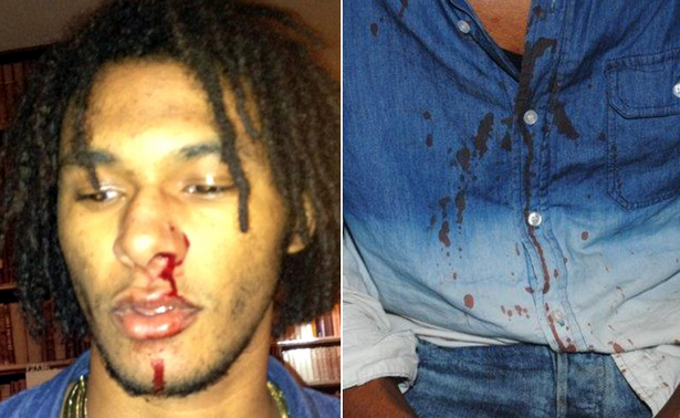 Ouch! Court Releases Bloody Chris Brown Bodyguard Assault Photos