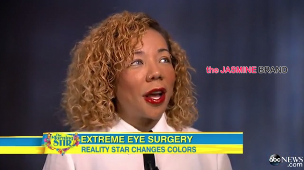 Tiny Defends Controversial Eye-Coloring Surgery on Good Morning America-the jasmine brand