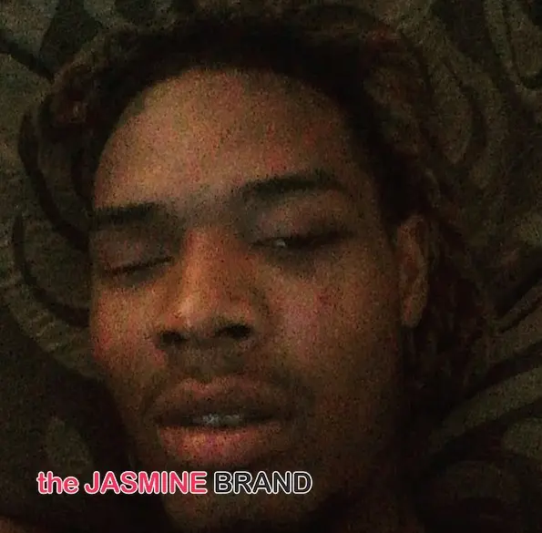 ‘I broke my leg in 3 places.’ Fetty Wap Releases Video After Motorcycle Accident + Receives Ticket For Having No Drivers License & Insurance