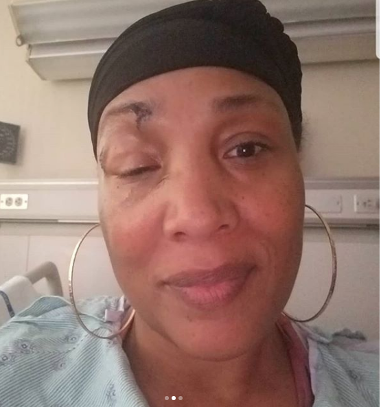 Lady of Rage Reveals Bloody & Bruised Face: Doctor’s Don’t Know What’s Wrong w/ Me