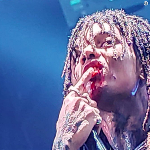 Swae Lee – Fan Violently Throws Phone On Stage, Hits Rapper In Mouth Splitting Lip Causing Stitches