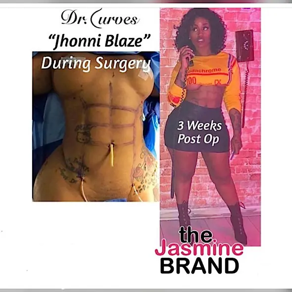 Reality Star Jhonni Blaze Opens Up About Getting Plastic Surgery Abs