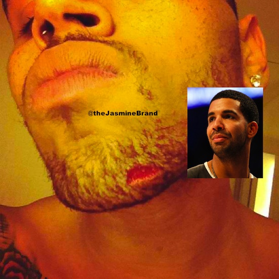 [Updated] Drake & Chris Brown Fight At Club, Drake Sent Note Before Brawl + 5 Injured