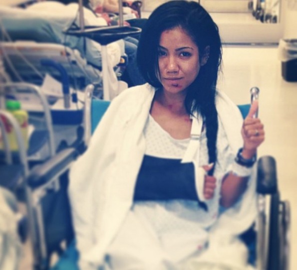 jhene aiko-injured in car accident-the jasmine brand