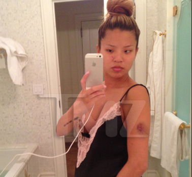 [Photos] Yikes! The Dream’s Baby Mama Photographed Injuries After Alleged Attack