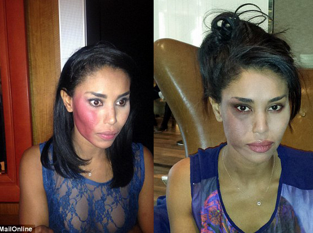 Man Arrested After Allegedly Attacking V. Stiviano + Alarming Photos Released