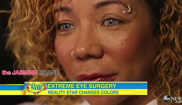 Tiny Defends Controversial Eye Coloring Surgery On Good Morning America [VIDEO]