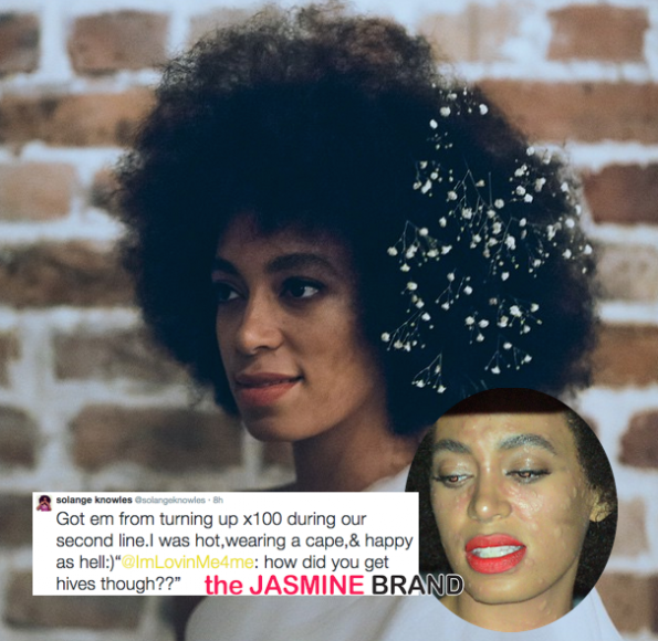 Solange Knowles-Explains Wedding Hives-the jasmine brand