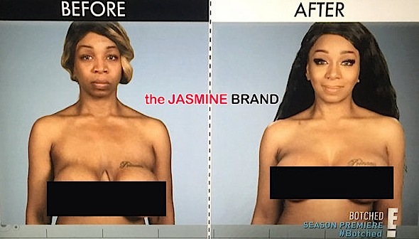 Reality Star 'New York' Gets Ginormous Breasts and Suffers-tiffany pollard-the jasmine brand