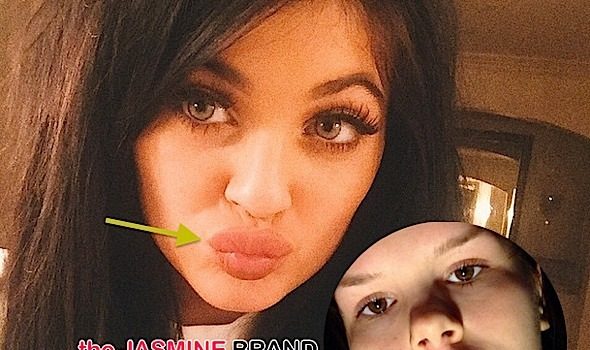 #KylieJennerLipChallenge Invades Social Media + See the Alarming Photos!
