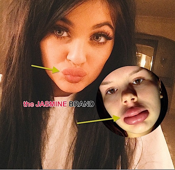 #KylieJennerLipChallenge Invades Social Media + See the Alarming Photos!