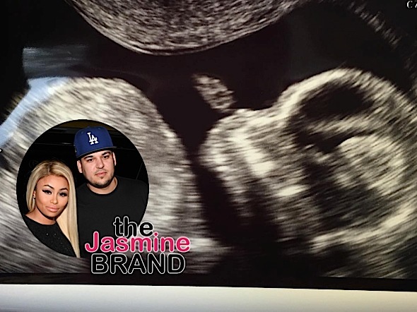 Blac Chyna & Rob Kardashian Will Sell Baby Kardashian’s 1st Photo For $1 Million