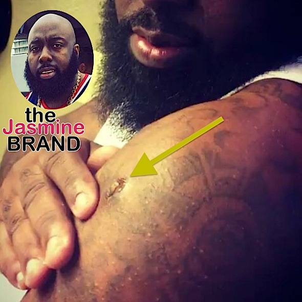 Ouch! Rapper Trae Tha Truth Squeezes Out Bullet [VIDEO]