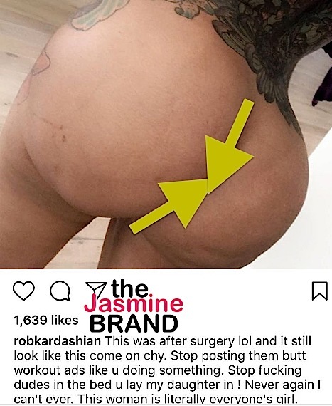 Rob Kardashian Spent $100,000 On Weight Loss Surgery, According to Blac Chyna