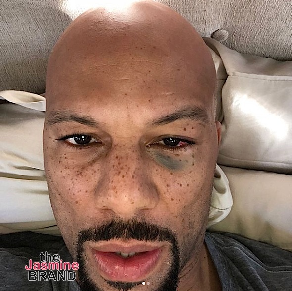 Amber Rose Fake Masturbates For the ‘Gram, Common Gets A Black Eye + Spice Girls Reunites