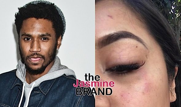 Trey Songz Denies Attacking Woman ‘I Am Being Lied On’ 