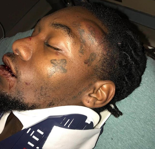 Cardi B’s Fiance Offset Shares Gruesome Car Crash Photos