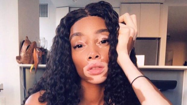 Winnie Harlow Apologizes After Being Accused Of Pushing A Woman Out The Way & Being A Typical Mean Girl At Party 
