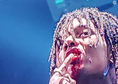 Swae Lee – Fan Violently Throws Phone On Stage, Hits Rapper In Mouth Splitting Lip Causing Stitches