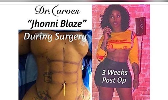 Reality Star Jhonni Blaze Opens Up About Getting Plastic Surgery Abs
