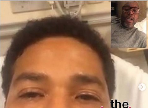 1st Look: Jussie Smollett’s Bruised Face Revealed After Brutal Attack [Photo]