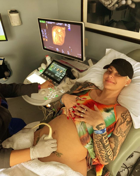 Amber Rose Is Pregnant W/ A Baby Boy! [Photos]