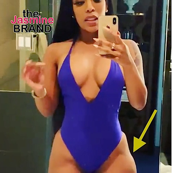 K.Michelle Teases New Plastic Surgery Show, Reveals Body & Shows Misshaped Thigh: That’s Where The Tissue Was Cut Out