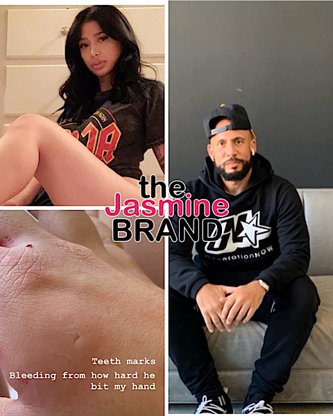 DJ Drama’s Girlfriend Alleges He Physically Attacked Her, Shares Graphic Video Of Scratch & Bite Marks [VIDEO]
