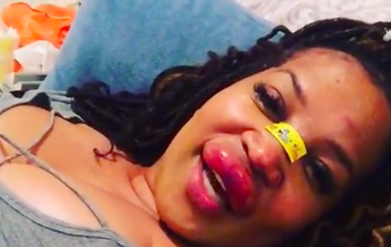 Kym Whitley Reveals Graphic Footage Of Her Swollen Lip, After Tripping & Falling In Hole ‘I’m Still Sexy!’ [VIDEO]