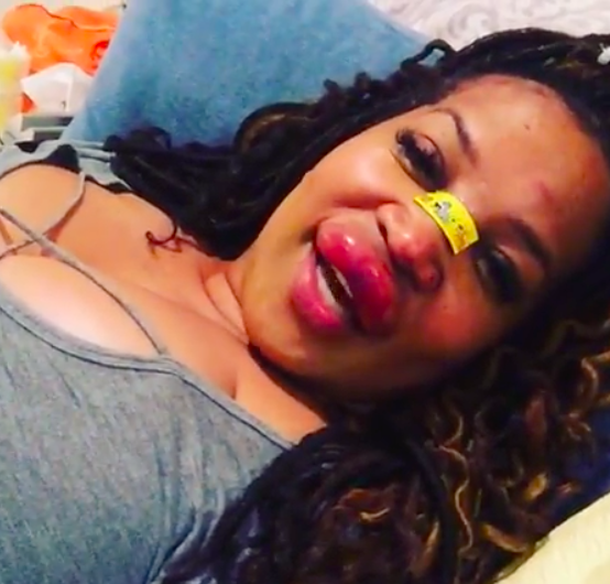 Kym Whitley Reveals Graphic Footage Of Her Swollen Lip, After Tripping & Falling In Hole ‘I’m Still Sexy!’ [VIDEO]