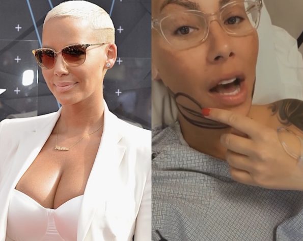 Amber Rose Is Recovering From Breast Reduction Surgery: 'I Might