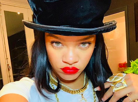Rihanna Recovering From Scooter Accident That Left Her W/ Multiple Bruises On Her Face