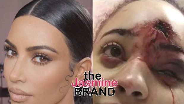 Kim Kardashian Offers To Pay Medical Bills For Minneapolis Protester Disfigured By Police’s Rubber Bullets