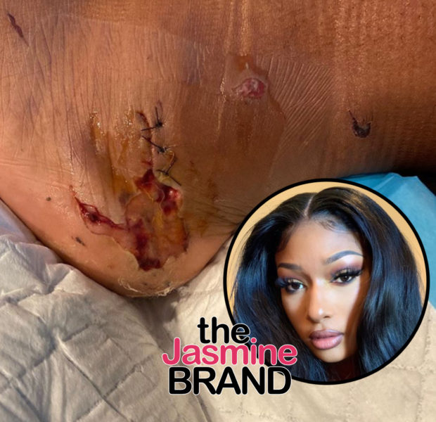 Megan Thee Stallion Reveals Graphic Photo Of Her Foot After Being Shot Allegedly By Tory Lanez