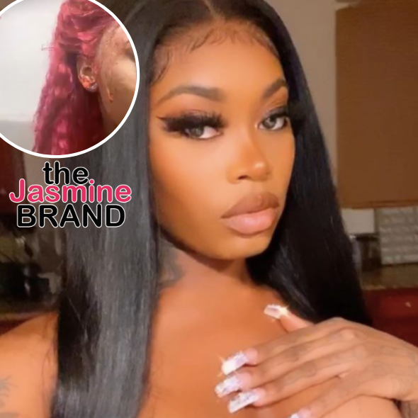 Asian Doll Involved In Serious Car Accident, Left W/ Bloody Face & Broken Arm: I Almost Lost My Life!