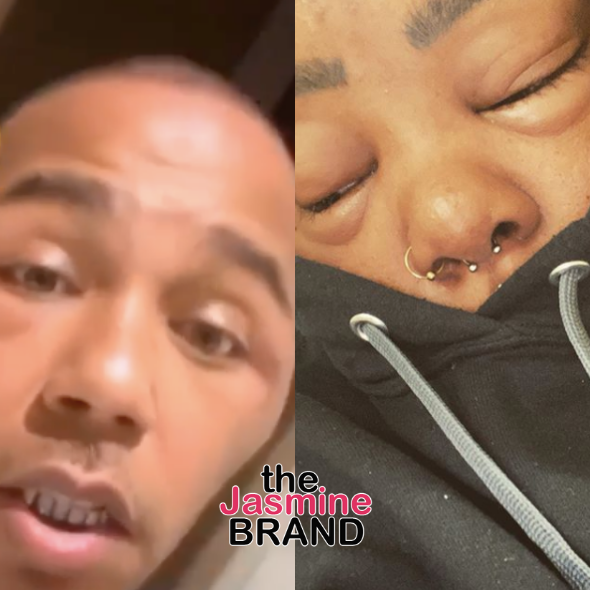 Yung Berg Shows His Face After Appearing To Suffer Severe Allergic Reaction, Rapper Tokyo Vanity Goes To ER With A Similar Case