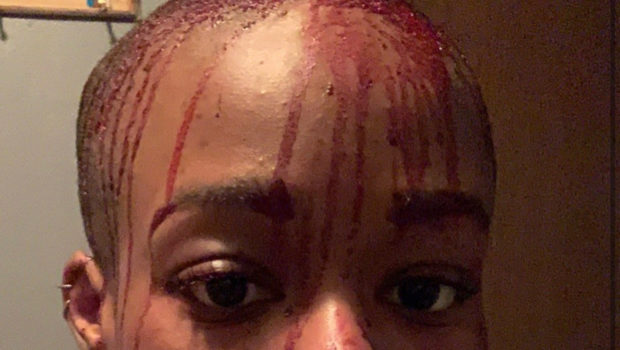 Azealia Banks’ Face Is Covered In Blood On Latest Social Media Post