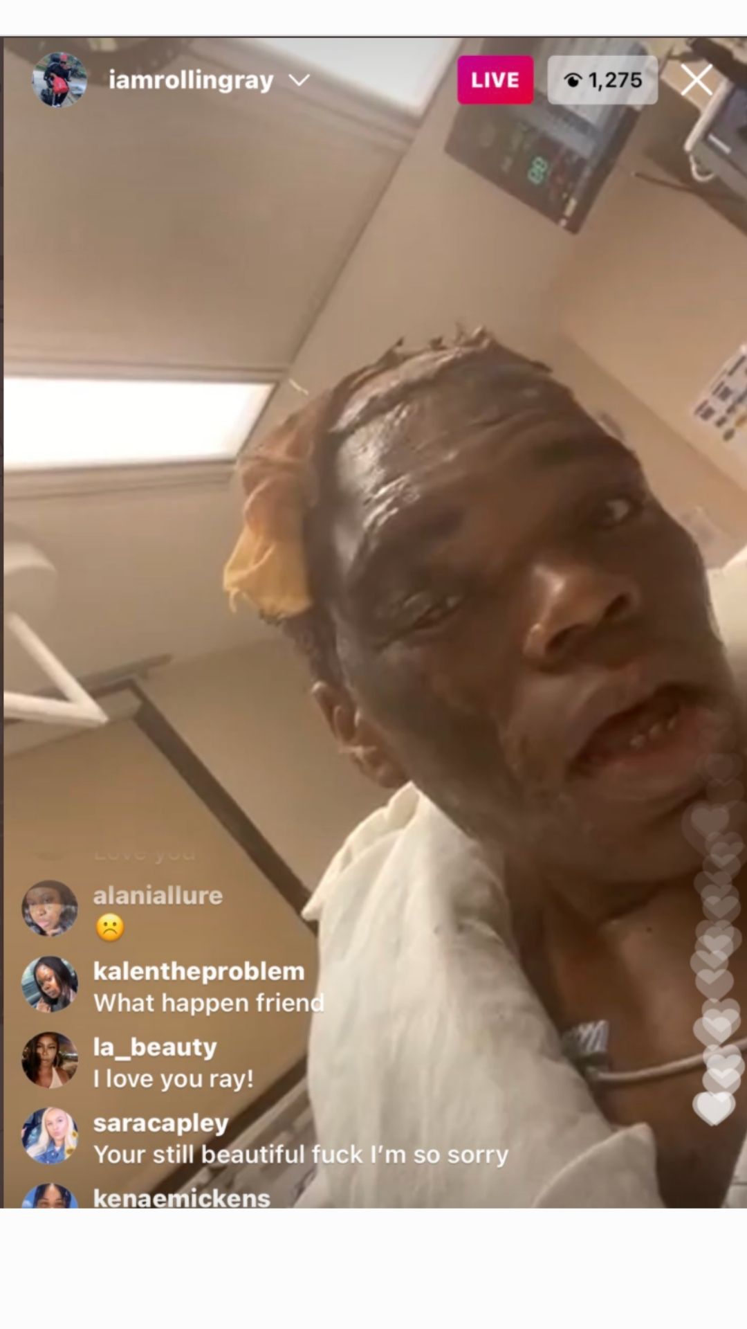 Personality Rolling Ray Hospitalized After His Wig Caught On