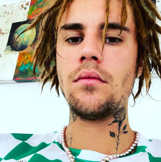 Justin Bieber Accused Of Cultural Appropriation After Debuting Dreads