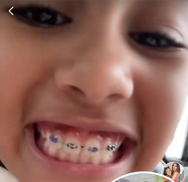 Kim Kardashian’s 8-Year-Old Daughter North West Shows Off Her New Braces
