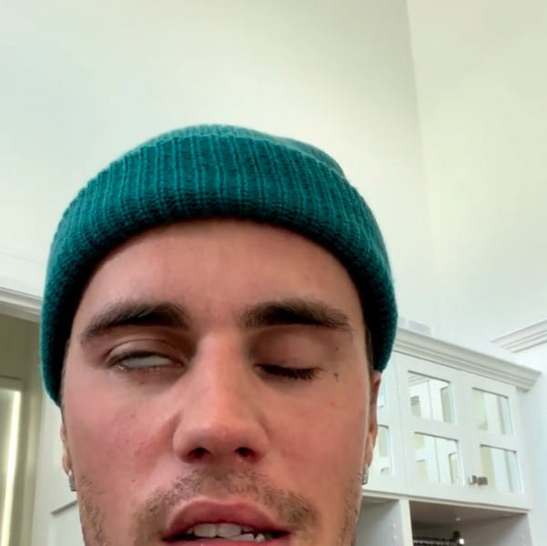 Justin Bieber Suffers From Virus That Causes Face Paralysis, Forcing Cancellation Of Several Tour Dates