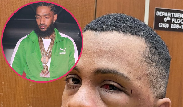 Nipsey Hussle’s Alleged Killer Eric Holder Appears In Court With Battered Face, Amidst Reports He Was Attacked In Jail