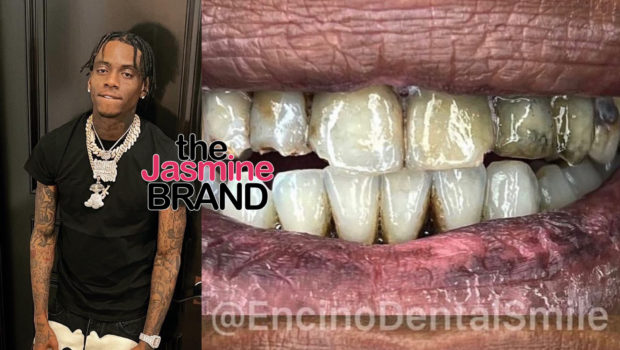 Soulja Boy – Social Media Reacts To His Teeth Before He Got Them Fixed