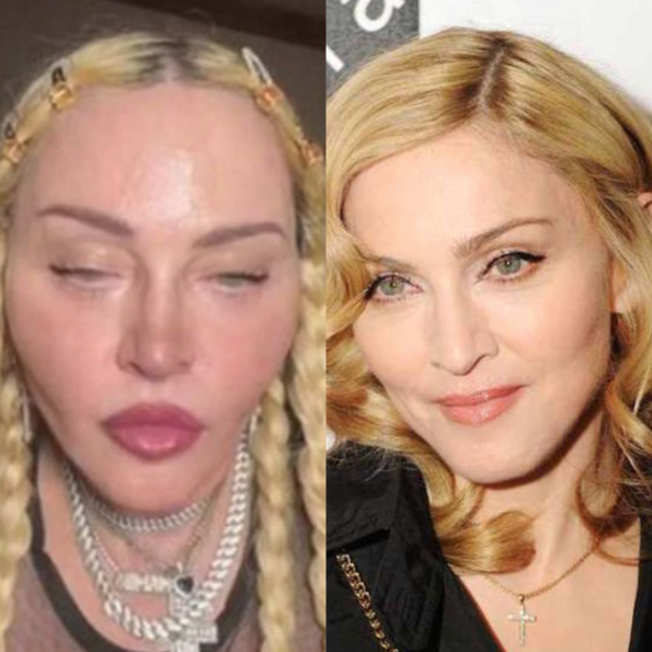 Madonna Undergoing Procedure To 