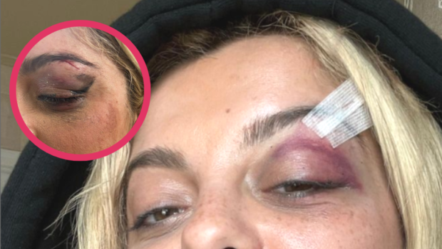 Update: Bebe Rexha Attacker Says He Hurled Phone At Singer’s Face Because He Felt ‘It Would Be Funny,’ Fan Charged w/ Assault & Aggravated Harassment