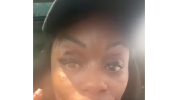 Tokyo Toni Shows Off Bruised Eye After Allegedly Being Hit w/ A Cup By A Starbuck’s Employee